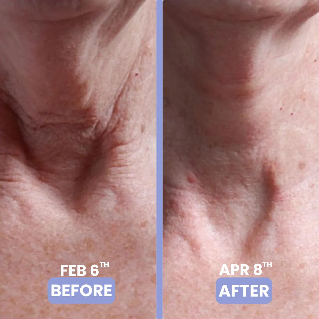 le' tighten & lift neck cream