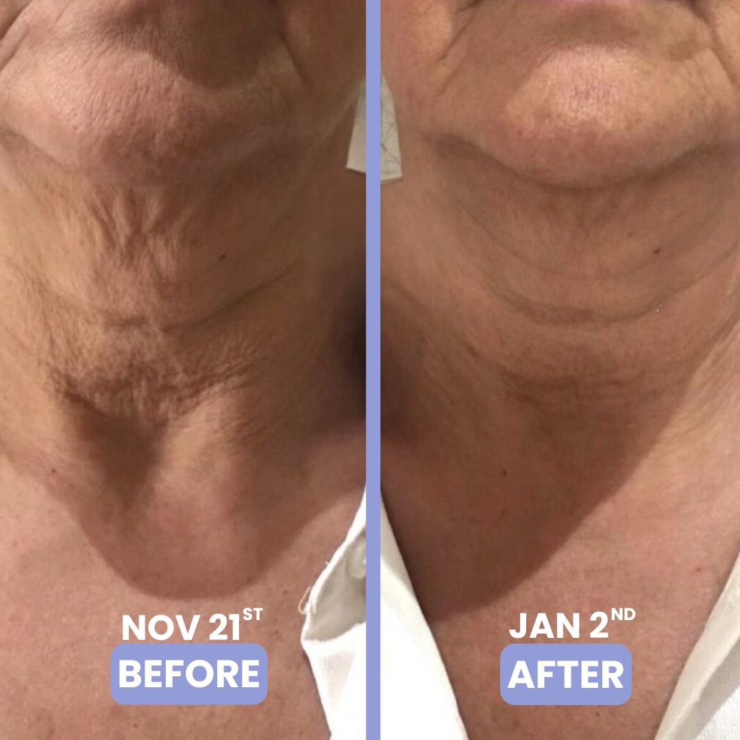 le' tighten & lift neck cream