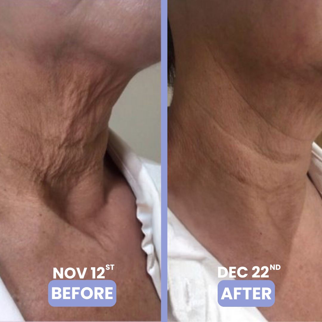le' tighten & lift neck cream