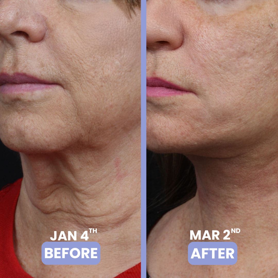 le' tighten & lift neck cream